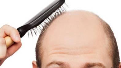 海口肤康医院专业治疗头发的各种顽疾