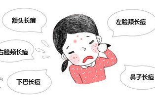 瘢痕体质病人平常应当留意些哪些