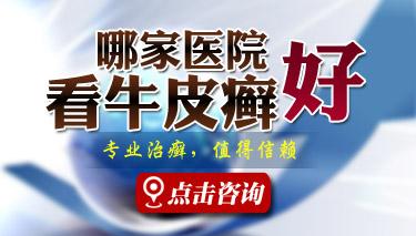 治疗银屑病所花的费用一般是多少