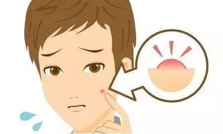除痘痘的方法